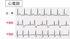 心電図